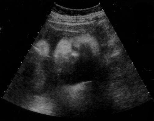 01-Ultrasound-Feb.jpg